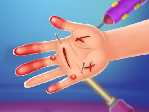 Play Hand Doctor Online